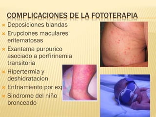 COMPLICACIONES DE LA FOTOTERAPIA
 Deposiciones blandas
 Erupciones maculares
eritematosas
 Exantema purpurico
asociado a porfirinemia
transitoria
 Hipertermia y
deshidratacion
 Enfriamiento por exposicion
 Sindrome del niño
bronceado
 