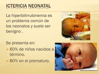ICTERICIA NEONATAL
La hiperbilirrubinemia es
un problema común de
los neonatos y suele ser
benigno .
Se presenta en:
 60% de niños nacidos a
término.
 80% en el prematuro.
 