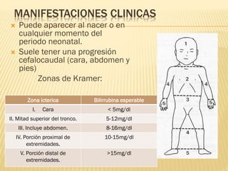 MANIFESTACIONES CLINICAS
 Puede aparecer al nacer o en
cualquier momento del
periodo neonatal.
 Suele tener una progresión
cefalocaudal (cara, abdomen y
pies)
Zonas de Kramer:
Zona icterica Bilirrubina esperable
I. Cara < 5mg/dl
II. Mitad superior del tronco. 5-12mg/dl
III. Incluye abdomen. 8-16mg/dl
IV. Porción proximal de
extremidades.
10-15mg/dl
V. Porción distal de
extremidades.
>15mg/dl
 