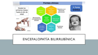 ENCEFALOPATÍA BILIRRUBÍNICA
 