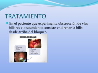 TRATAMIENTO
En el paciente que experimenta obstrucción de vías
biliares el tratamiento consiste en drenar la bilis
desde arriba del bloqueo
 