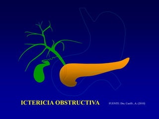 ICTERICIA OBSTRUCTIVA FUENTE: Dra. Casilli , A. (2010)
 