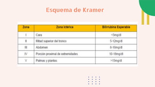 Esquema de Kramer
 