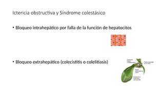 Ictericia obstructiva y Síndrome colestásico
• Bloqueo intrahepático por falla de la función de hepatocitos
• Bloqueo extrahepático (colecistitis o colelitiasis)
 