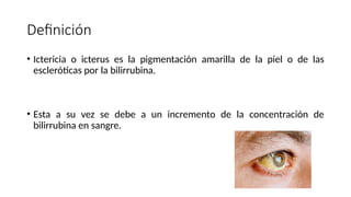 Definición
• Ictericia o icterus es la pigmentación amarilla de la piel o de las
escleróticas por la bilirrubina.
• Esta a su vez se debe a un incremento de la concentración de
bilirrubina en sangre.
 