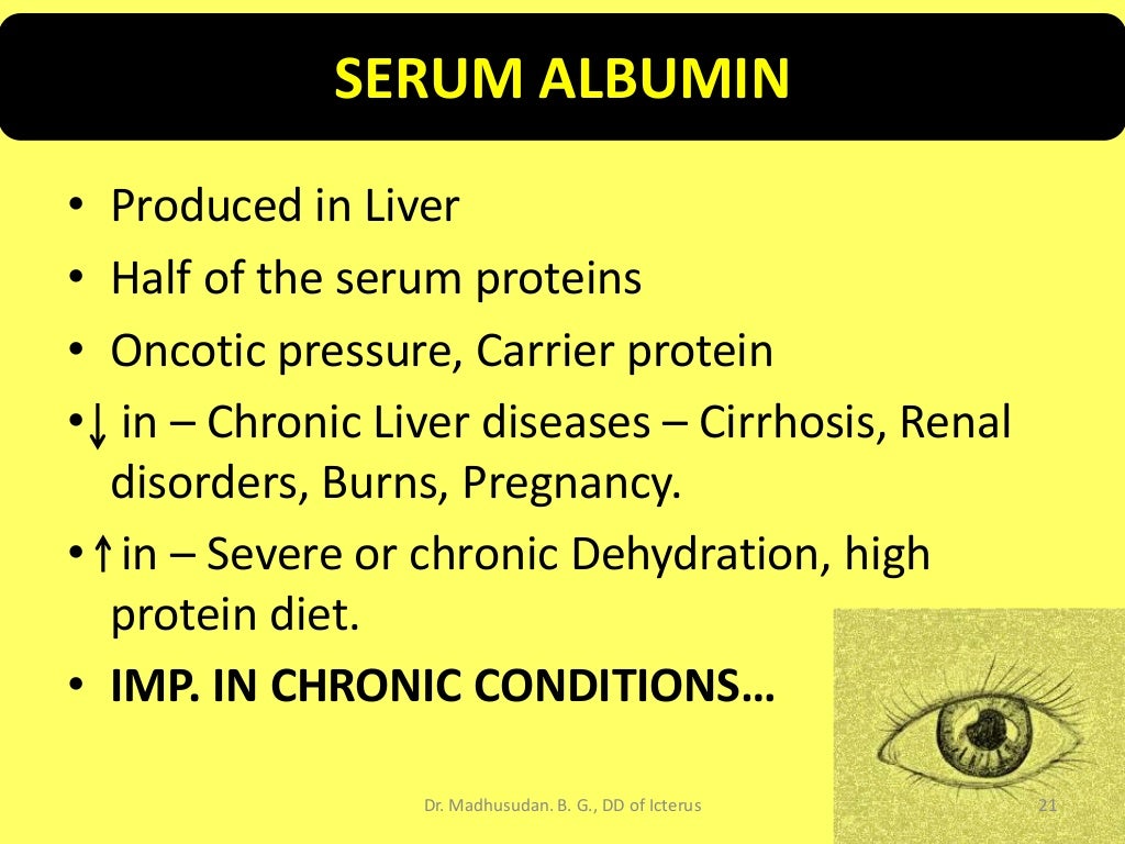 Differential Diagnosis of Icterus/Jaundice