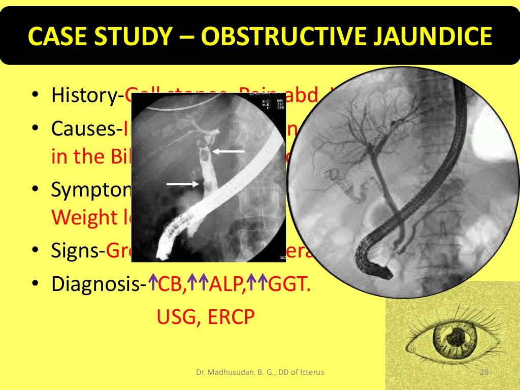 Differential Diagnosis of Icterus/Jaundice