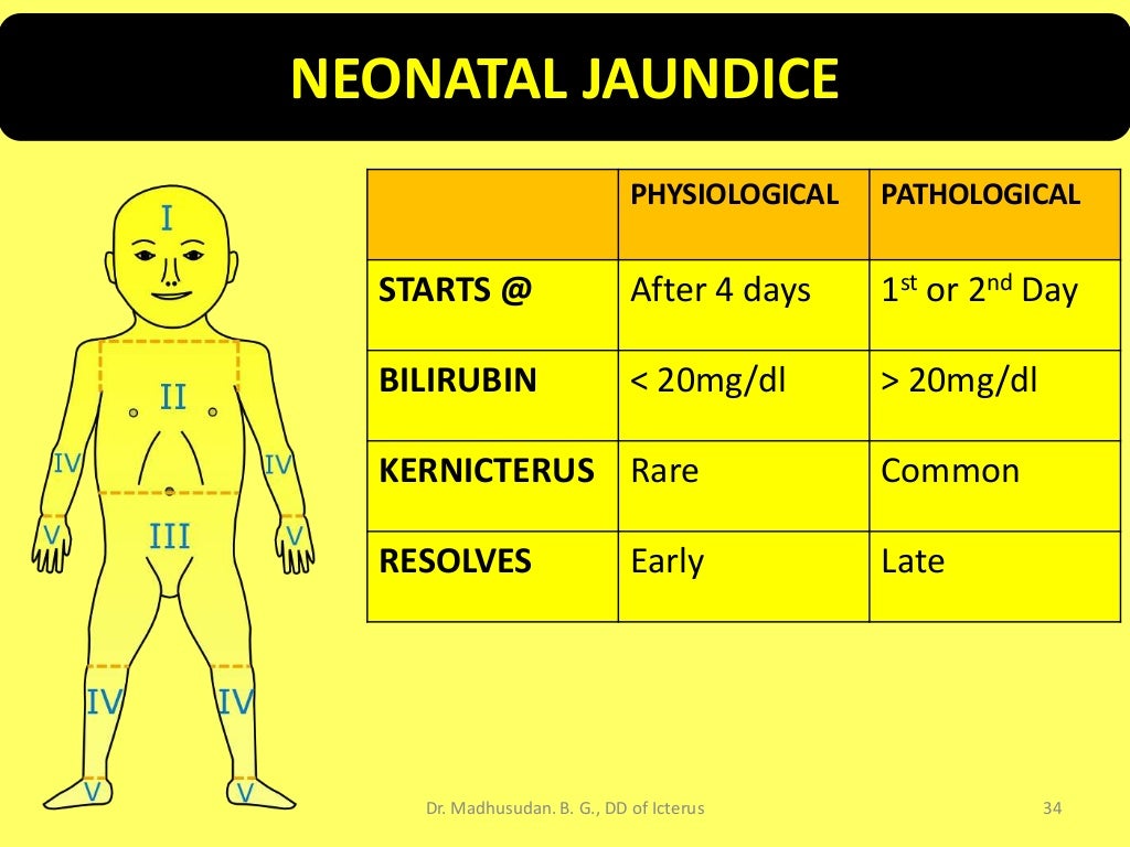 Differential Diagnosis of Icterus/Jaundice