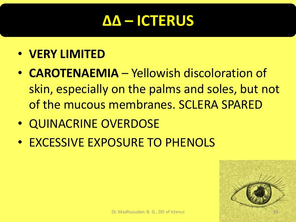 Differential Diagnosis of Icterus/Jaundice