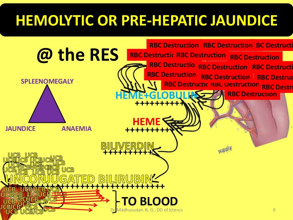 Differential Diagnosis of Icterus/Jaundice