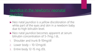 Jaundice in the newborn/ neonatal
jaundice
 Neo natal jaundice is a yellow discoloration of the
white part of the eyes and skin in a newborn baby
due to high bilirubin level.
 Neo natal jaundice becomes apparent at serum
bilirubin concentration of 5-7mg / dL.
1. Shoulder and trunk 8-10mg/dl
2. Lower body – 10-12mg/dl.
3. Entire body 12-15 mg /DL
 