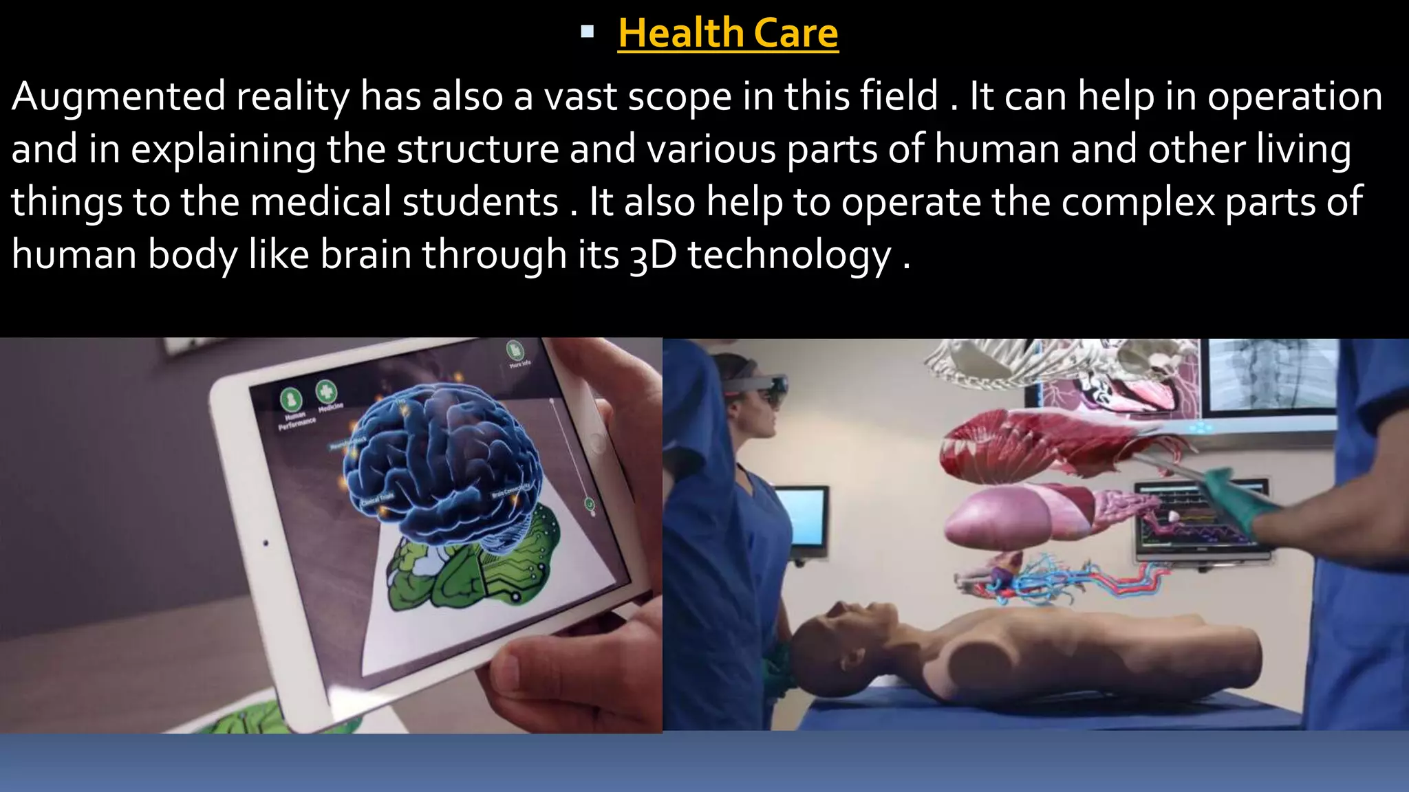  Health Care
Augmented reality has also a vast scope in this field . It can help in operation
and in explaining the structure and various parts of human and other living
things to the medical students . It also help to operate the complex parts of
human body like brain through its 3D technology .
 