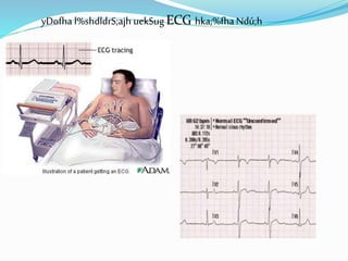 yDofha l%shdldrS;ajh uekSug ECG hka;%fha Ndú;h
 