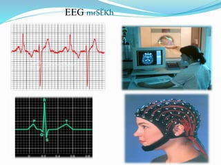 EEG mrSËKh
 