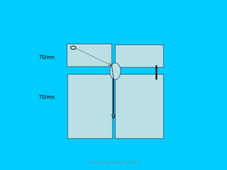groupe de rythmologie du CNCH
70/mn
70/mn