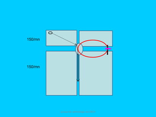 groupe de rythmologie du CNCH
150/mn
150/mn