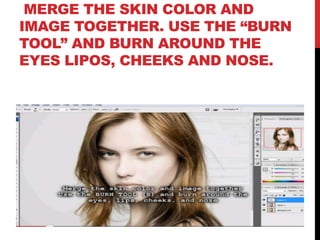 MERGE THE SKIN COLOR AND
IMAGE TOGETHER. USE THE “BURN
TOOL” AND BURN AROUND THE
EYES LIPOS, CHEEKS AND NOSE.
 