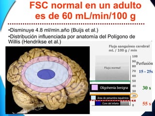 FSC normal en un adulto es de 60 mL/min/100 g • Disminuye 4.8 ml/min.año (Buijs et al.)  • Distribución influenciada por anatomía del Polígono de Willis (Hendrikse et al.) 15 - 25s 30 s 55 s Perfusión 