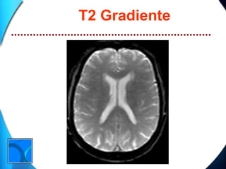 T2 Gradiente 