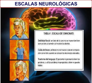 ESCALAS NEUROLÓGICAS
 