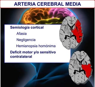 Semiologia cortical
Afasia
Negligencia
Hemianopsia homónima
Deficit motor y/o sensitivo
contralateral
ARTERIA CEREBRAL MEDIA
 
