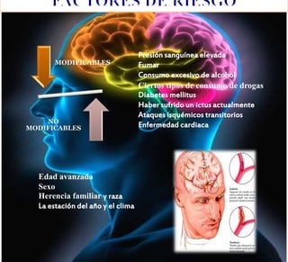 MODIFICABLES
NO
MODIFICABLES
Edad avanzada
Sexo
Herencia familiar y raza
La estación del año y el clima
Presión sanguínea elevada
Fumar
Consumo excesivo de alcohol
Ciertos tipos de consumo de drogas
Diabetes mellitus
Haber sufrido un ictus actualmente
Ataques isquémicos transitorios
Enfermedad cardiaca
 