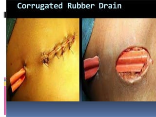 Corrugated Rubber Drain
 