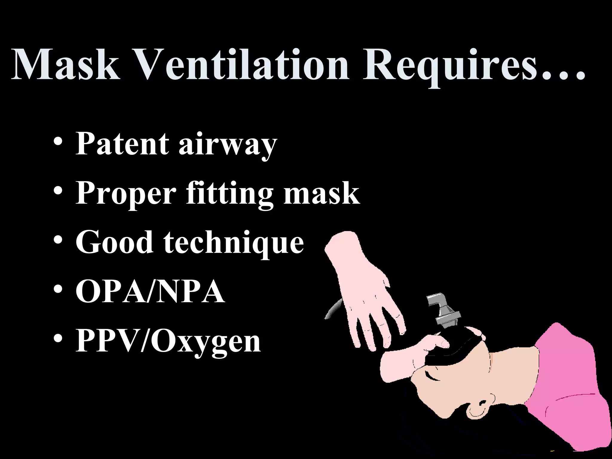 Mask Ventilation Requires …  Patent airway Proper fitting mask Good technique OPA/NPA PPV/Oxygen 