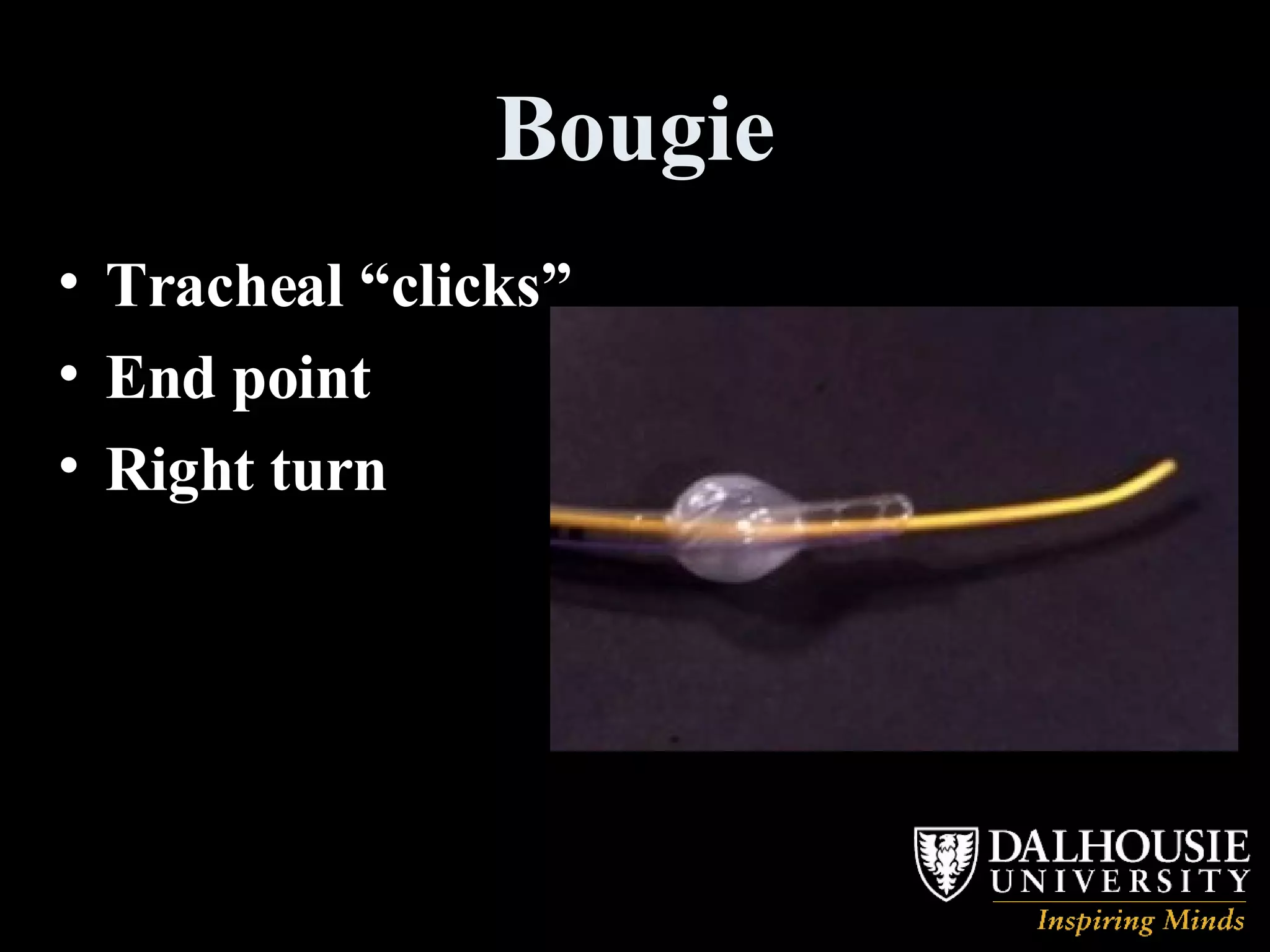 Bougie Tracheal “clicks” End point Right turn 