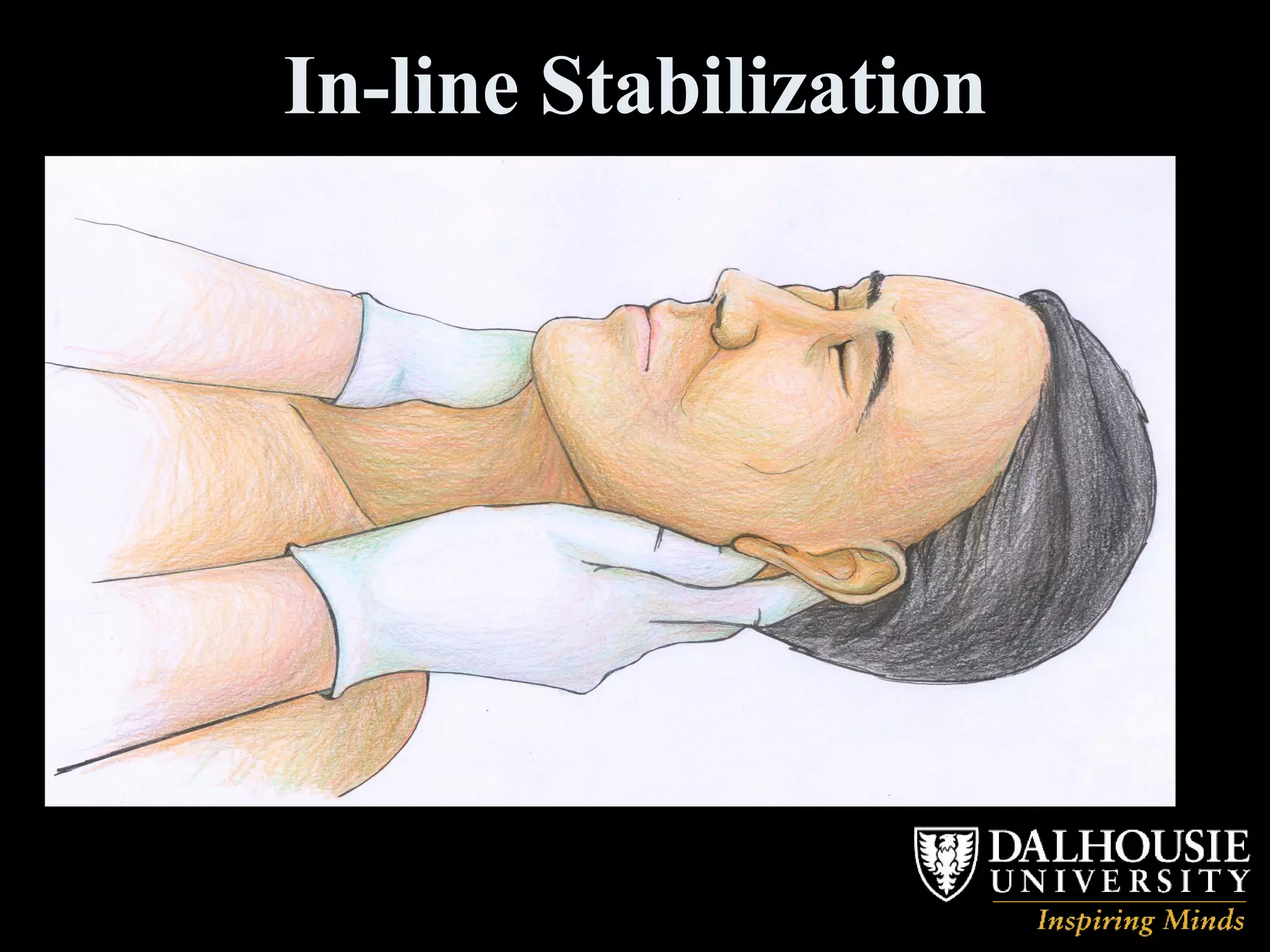 In-line Stabilization 
