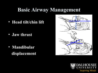 Basic Airway Management Head tilt/chin lift Jaw thrust Mandibular displacement 