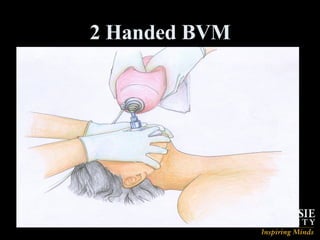 2 Handed BVM 