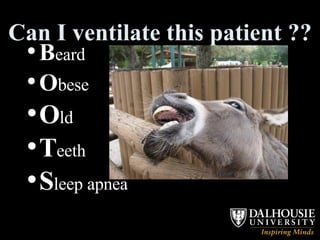 Can I ventilate this patient ?? B eard O bese O ld T eeth  S leep apnea 