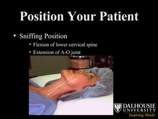 Position Your Patient Sniffing Position Flexion of lower cervical spine Extension of A-O joint 