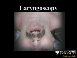 Laryngoscopy 