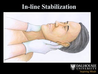 In-line Stabilization 
