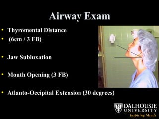 Airway Exam Thyromental Distance (6cm / 3 FB) Jaw Subluxation Mouth Opening (3 FB) Atlanto-Occipital Extension (30 degrees) 