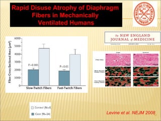 Rapid Disuse Atrophy of Diaphragm 
12 Levine et al. NEJM 2008 
Fibers in Mechanically 
Ventilated Humans 
 