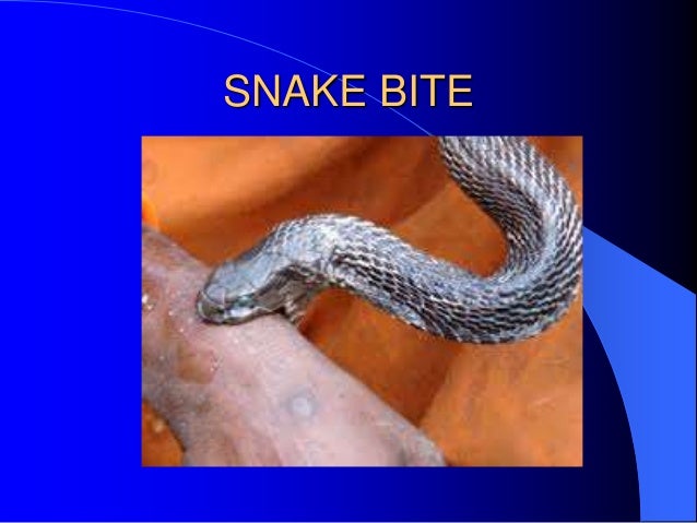 Initial assessment of critically ill patients(PRESENTED AT 