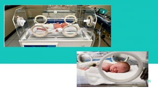 ICU AND IT'S TYPES | PPTX