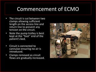 ICU management of ECMO pt | PPSX