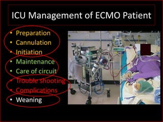 ICU management of ECMO pt | PPSX