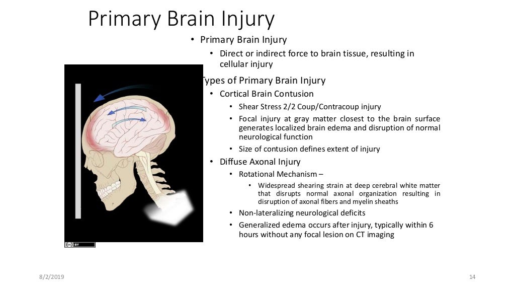 ICU management of traumatic brain injury