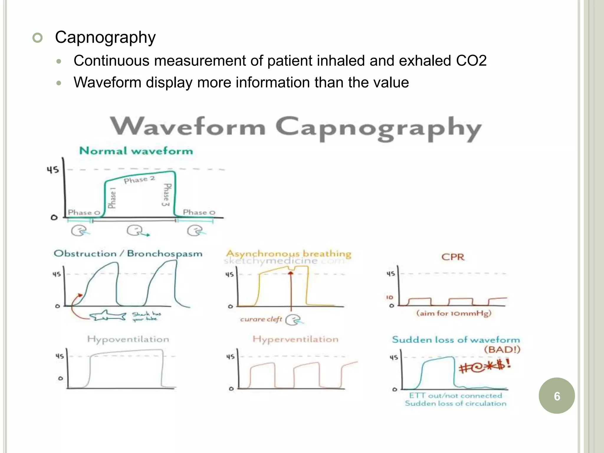 Icu monitoring | PPTX