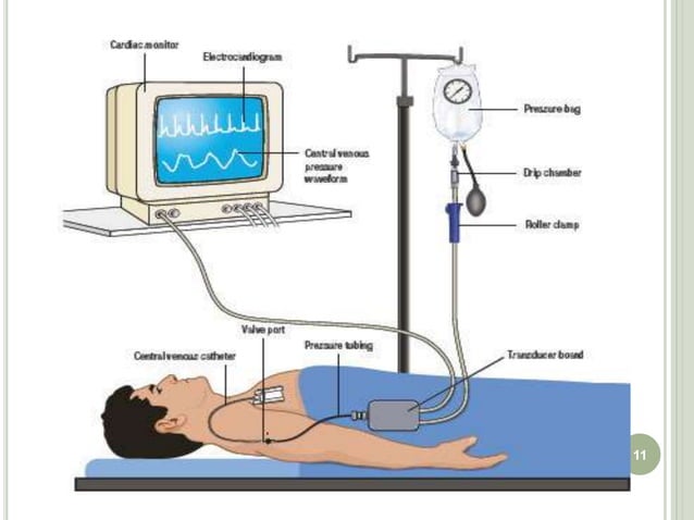 Icu monitoring | PPTX | Heart and Cardiovascular Diseases | Diseases ...