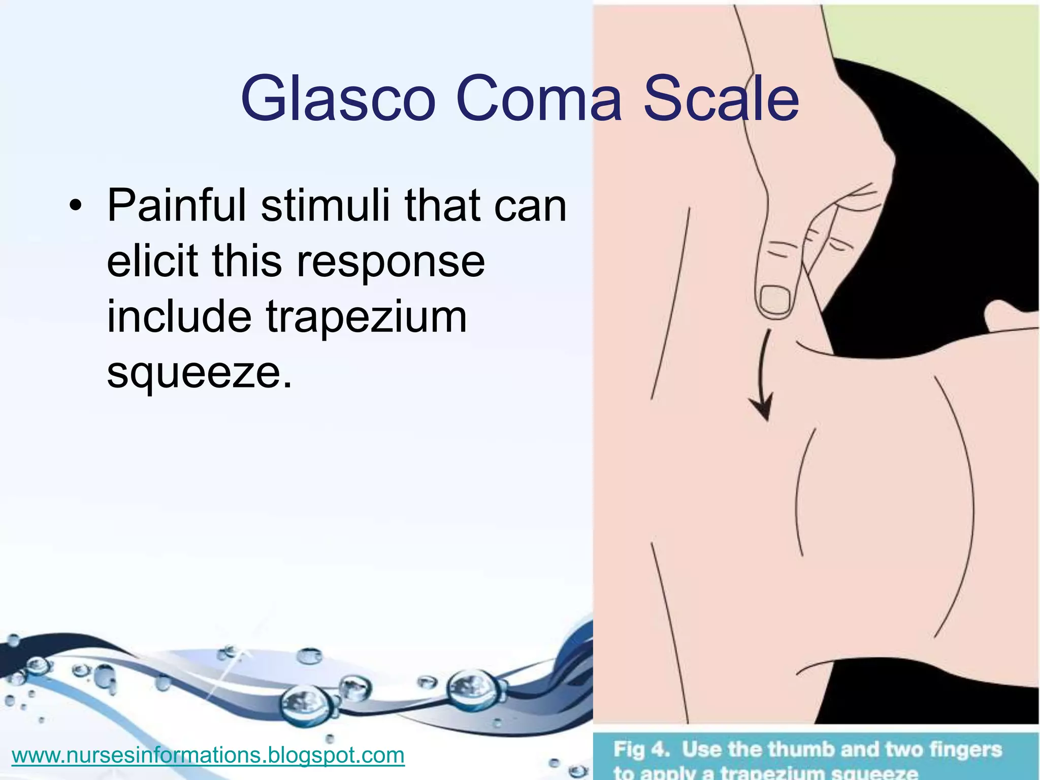 Glasco Coma Scale
    • Painful stimuli that can
      elicit this response
      include trapezium
      squeeze.




www.nursesinformations.blogspot.com
 