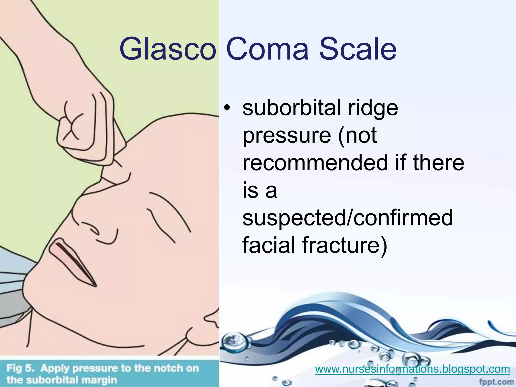 Glasco Coma Scale
      • suborbital ridge
        pressure (not
        recommended if there
        is a
        suspected/confirmed
        facial fracture)




              www.nursesinformations.blogspot.com
 