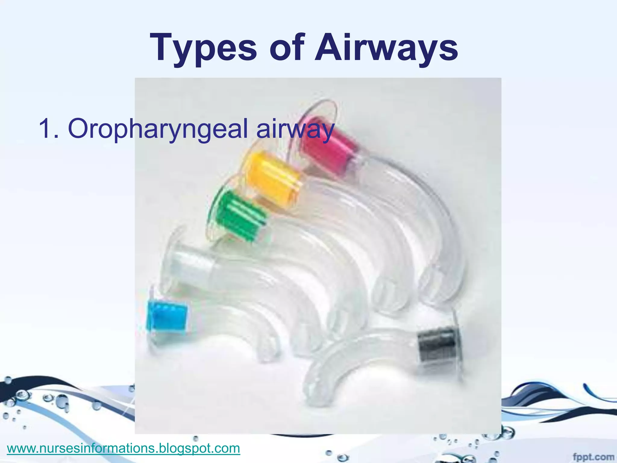 Types of Airways

    1. Oropharyngeal airway




www.nursesinformations.blogspot.com
 