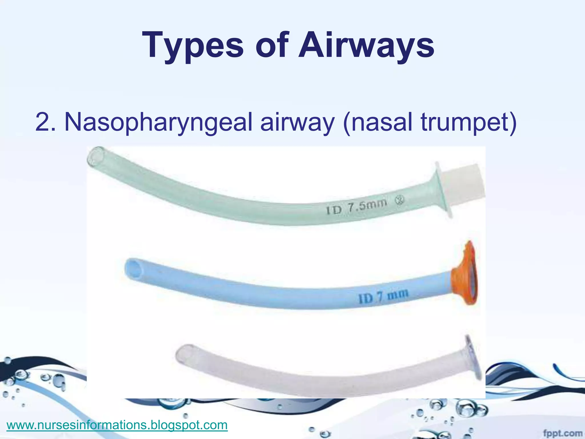 Types of Airways

    2. Nasopharyngeal airway (nasal trumpet)




www.nursesinformations.blogspot.com
 