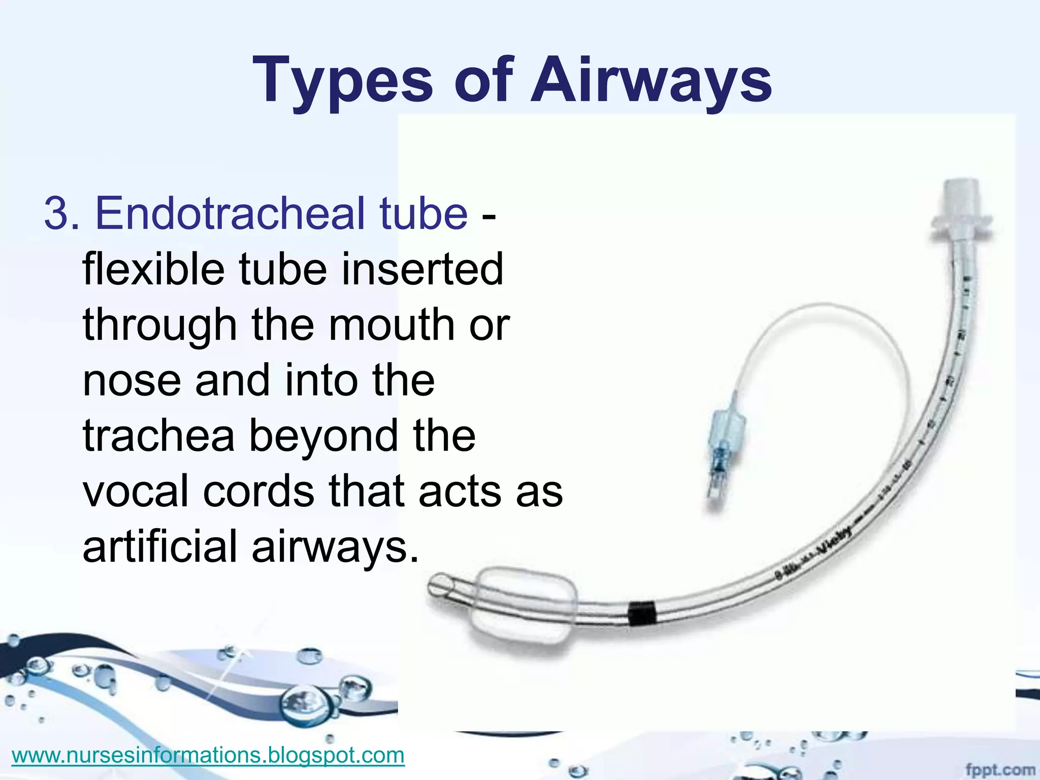 Types of Airways

  3. Endotracheal tube -
    flexible tube inserted
    through the mouth or
    nose and into the
    trachea beyond the
    vocal cords that acts as
    artificial airways.



www.nursesinformations.blogspot.com
 